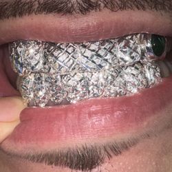 💎 Diamond Dust & Diamond-Cut Silver Grills 💎