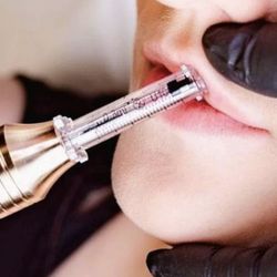 FillerforLipsandFacial