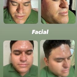 Facial