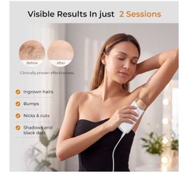 Laser hair removal