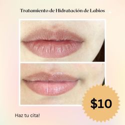 Limpieza Facial Más Hidratación De Labios Por 40 Dollares