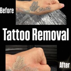 Removal 
