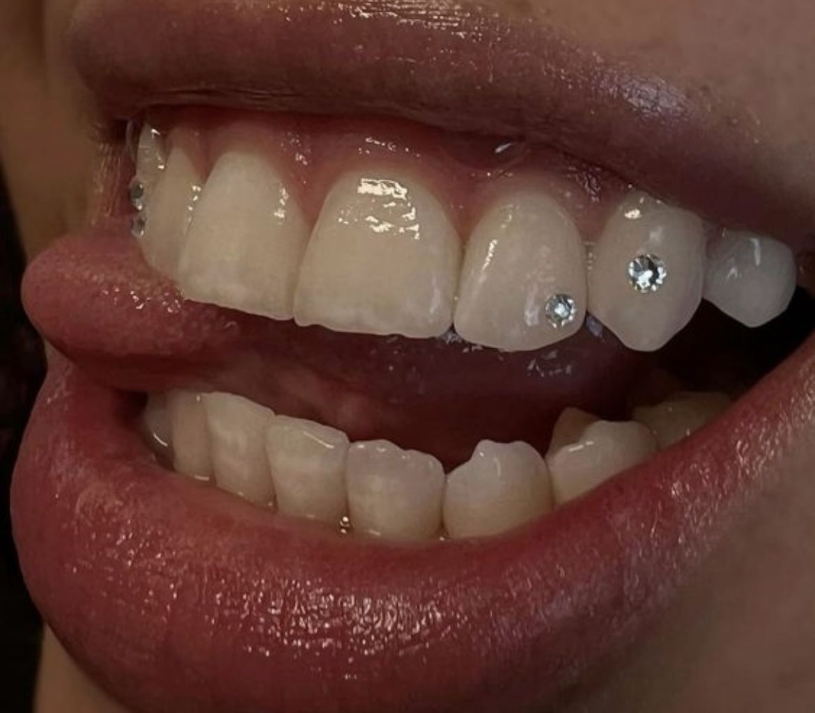 Tooth Gems  Tyler Area 