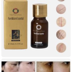 Acne stretch marks scar removal