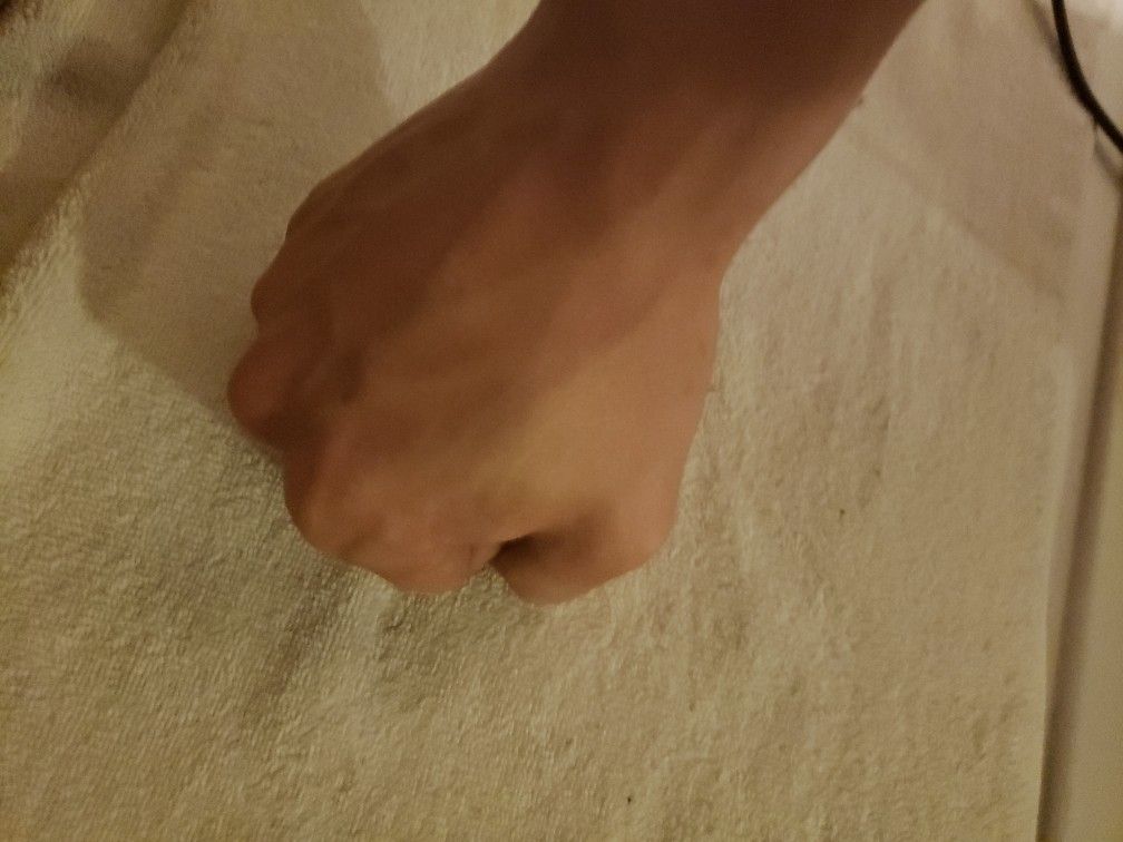 These Hands