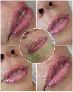 Hidratacion En Labios