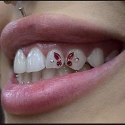 Tooth Gem