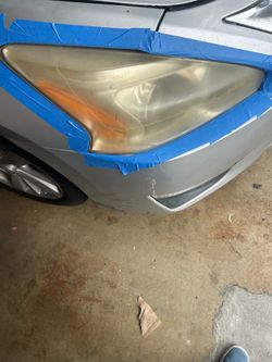 Light restoration $80