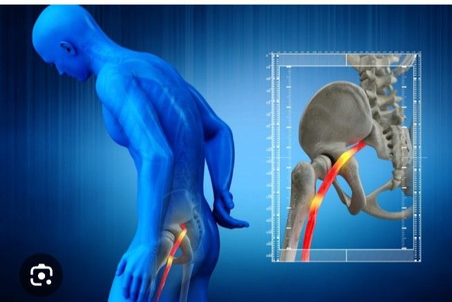 Huesero Y Sobador 🙏