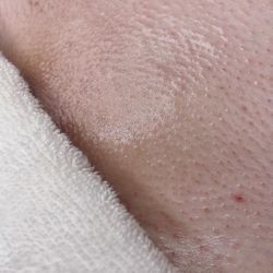 Brazilian wax