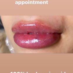Lips