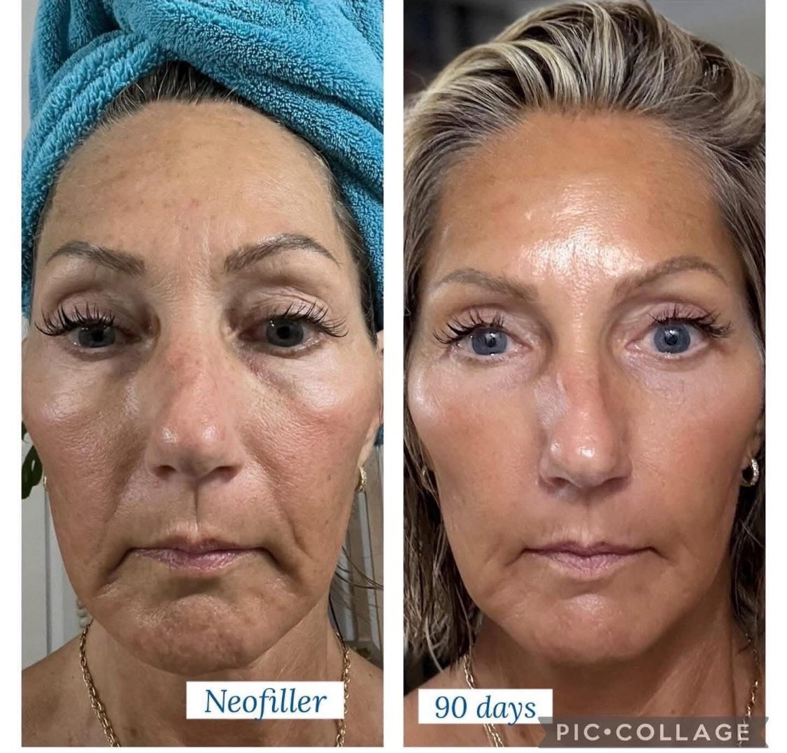 Botox En Crema Vegano Prueba Gratis