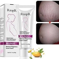 Best Stretch Mark Remover 