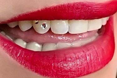 Tooth Gem