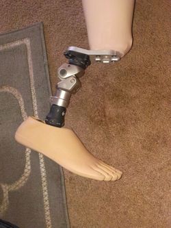 TRULIFE PROSTHETIC