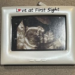 Love At First Sight Ultrasound Sonogram Picture Frame Personalizable Ornament