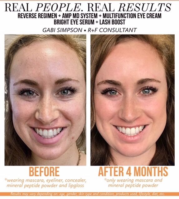 Rodan and fields