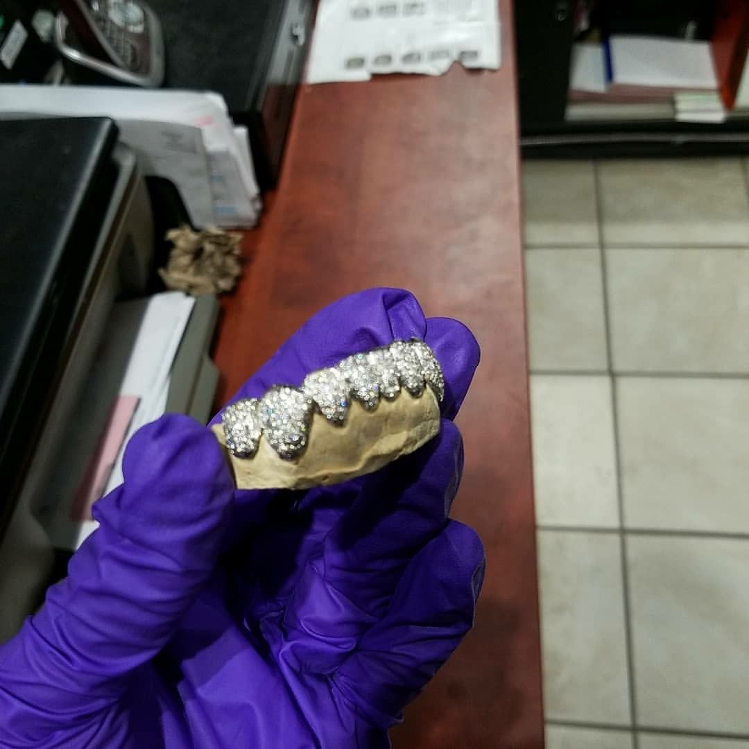 Gold teeth special