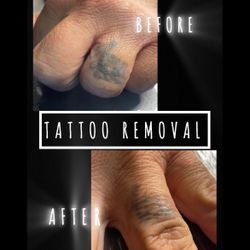 Removal