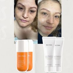 Con Este Potente Producto Desaste De Esas Manchas Incómodas En El Restro