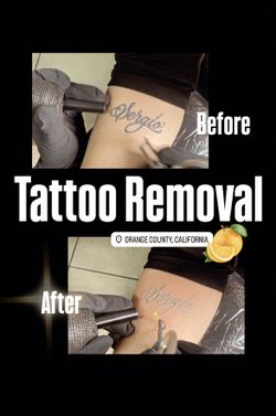 Removal