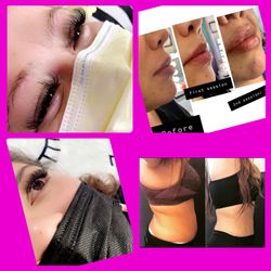 Lashes , Lips And Body Contouring