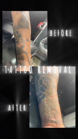 Removal