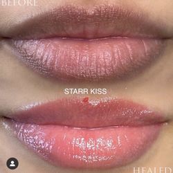Lip Blush, Lip Neutralization, Permanent lip color