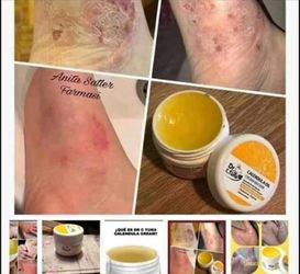 Calendula