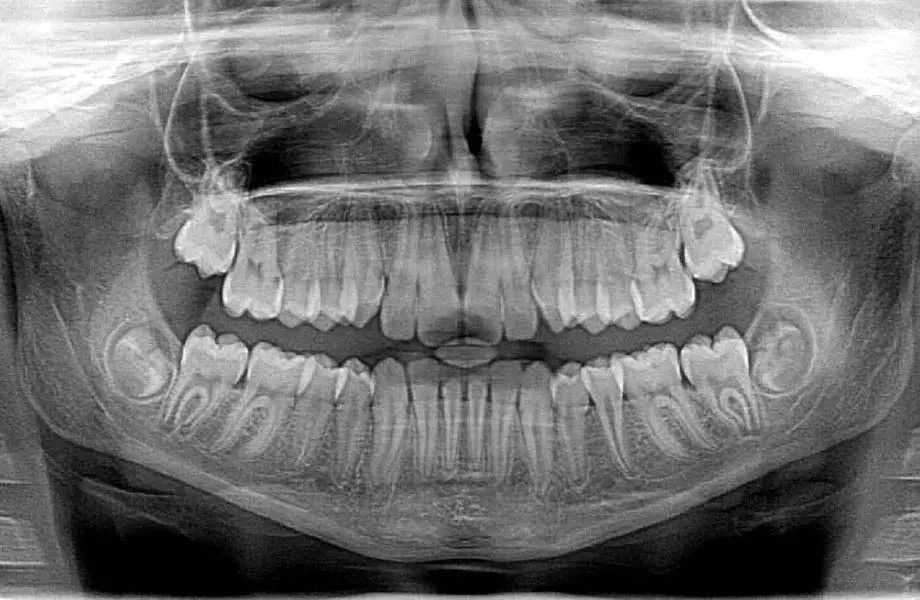 15 Years exprience in Dental