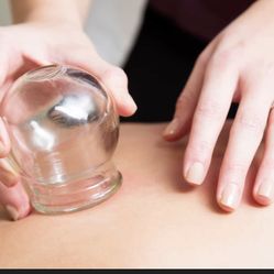 ventosas masaje terapia 