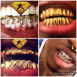 Gold Grills