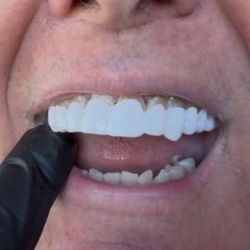 Click-On Smile