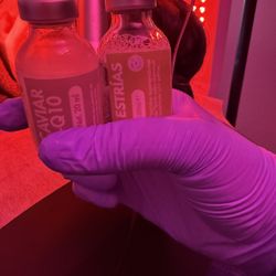 ✨Microneedling  Treatment ✨