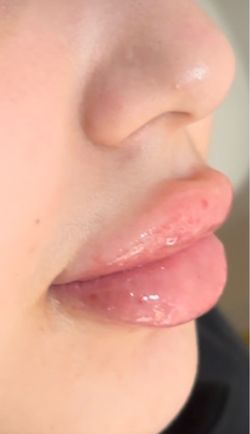 Lip Gloss