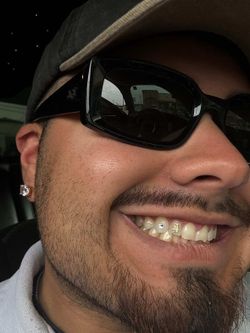Tooth gems