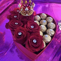 Rose And Chocolate Arrangement