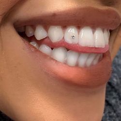 Teeth gems 💎