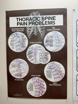 Clinical chart (Thoracic Spine)