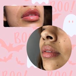 Lip filler gloss