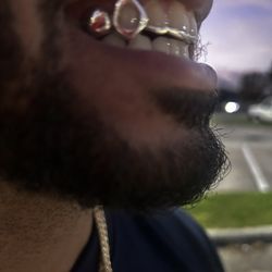 Custom Silver/Gold Plated Grillz Orlando Florida