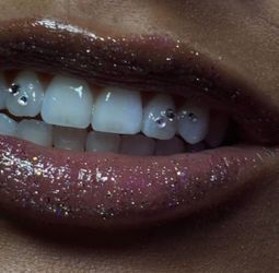 Toothgems