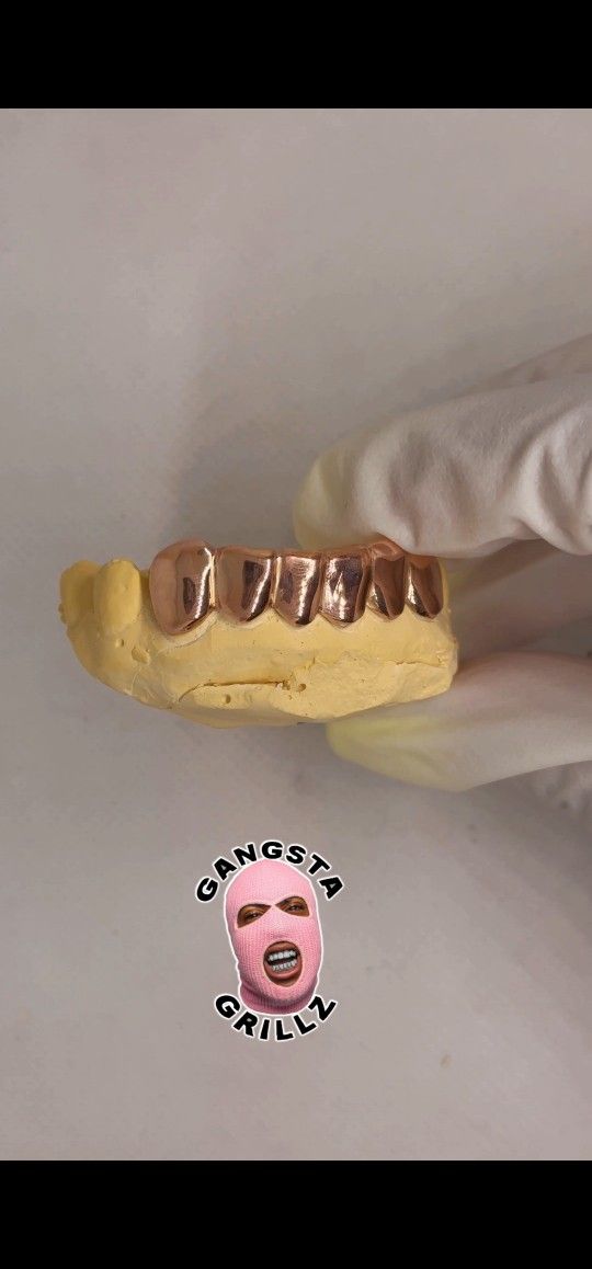 Gold Grillz