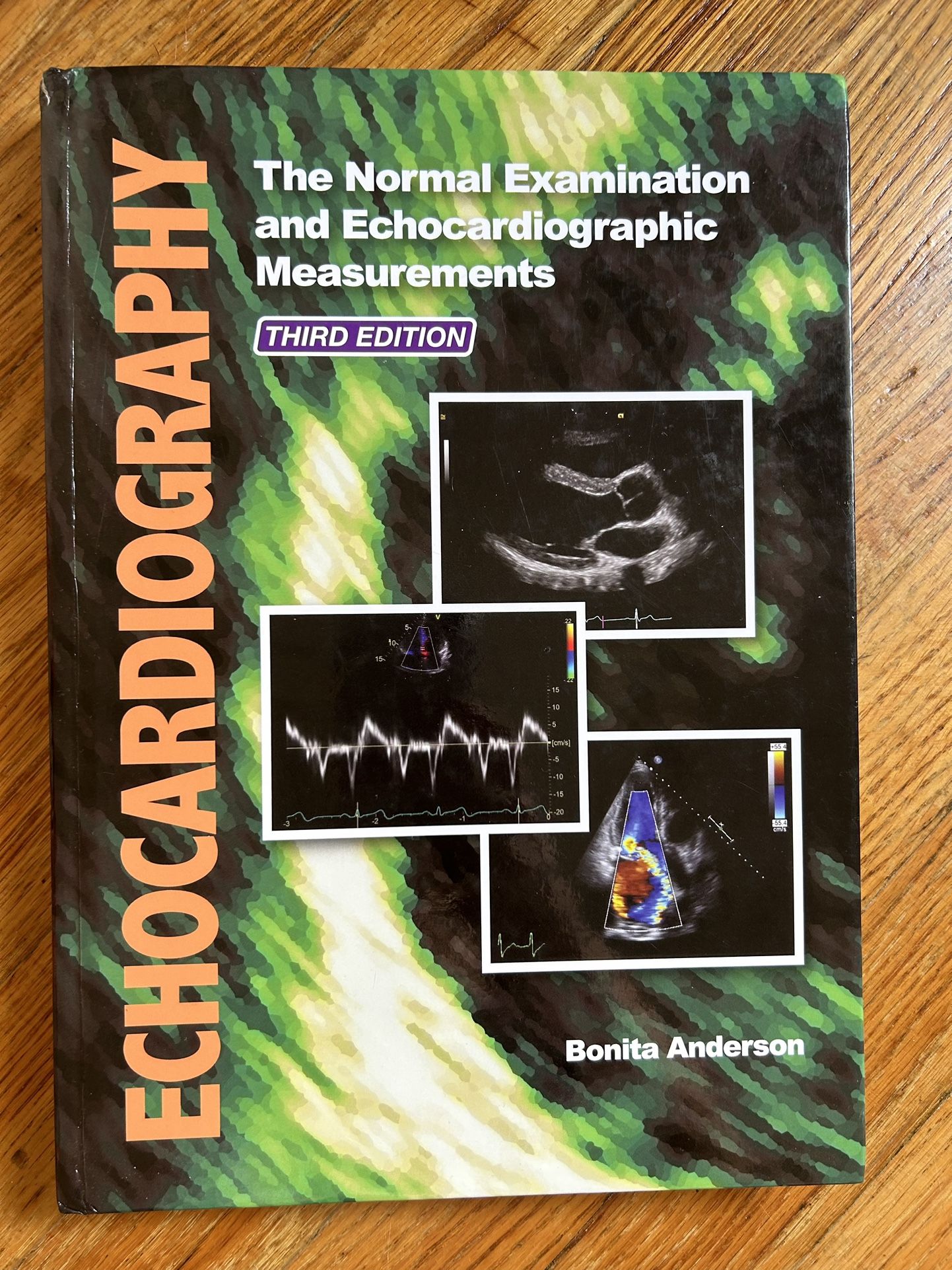 Exhocardiography: The Normal Examination And Echocardiographic Measurements