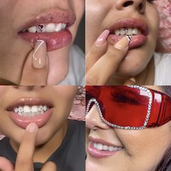 Tooth Gems|Teeth Whitening 🦷✨