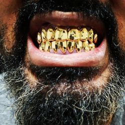 Gold Grills 