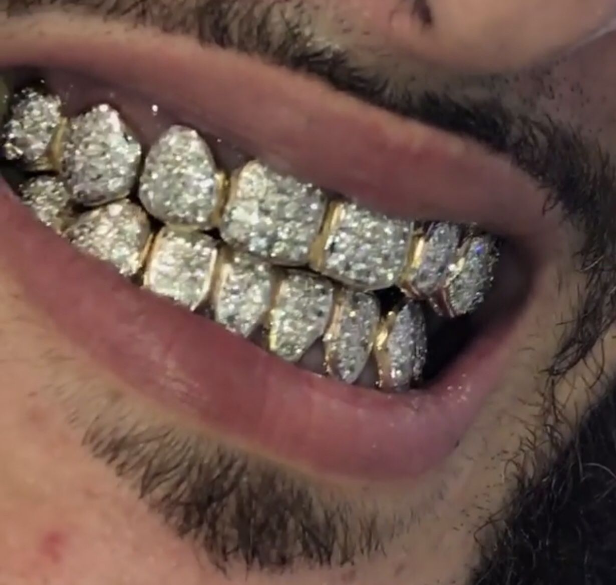 real-gold-teeth-diamonds-vs-real-vvs-for-sale-in-homestead-fl-offerup