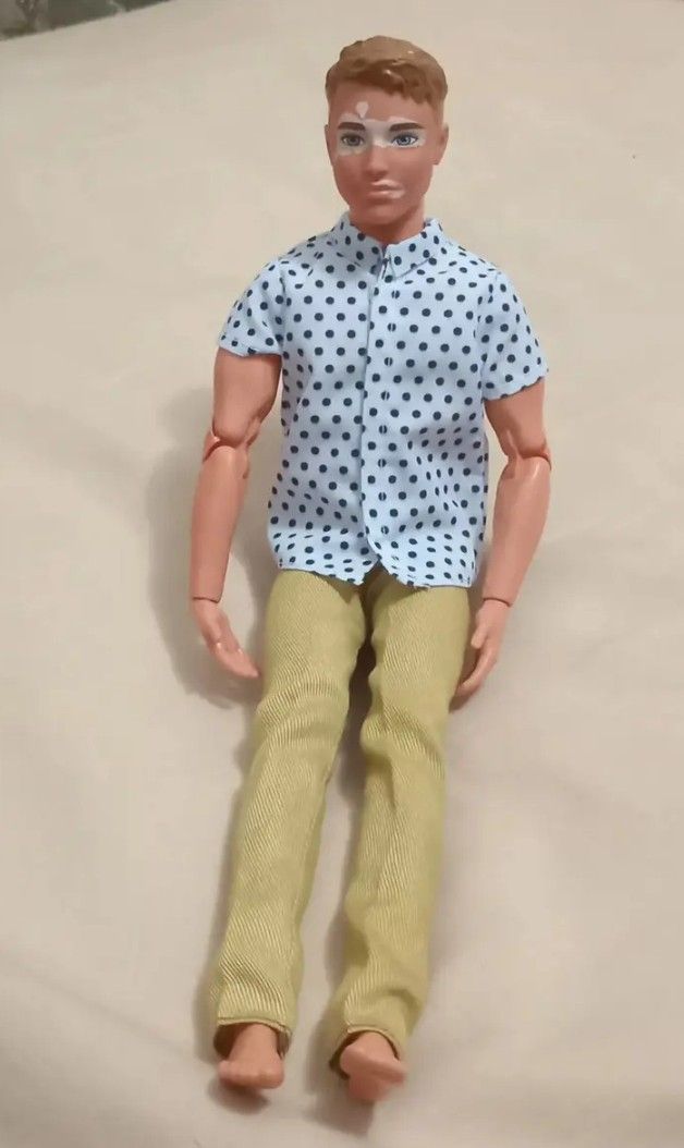 Fashonista Ken Doll with Virtiligo.