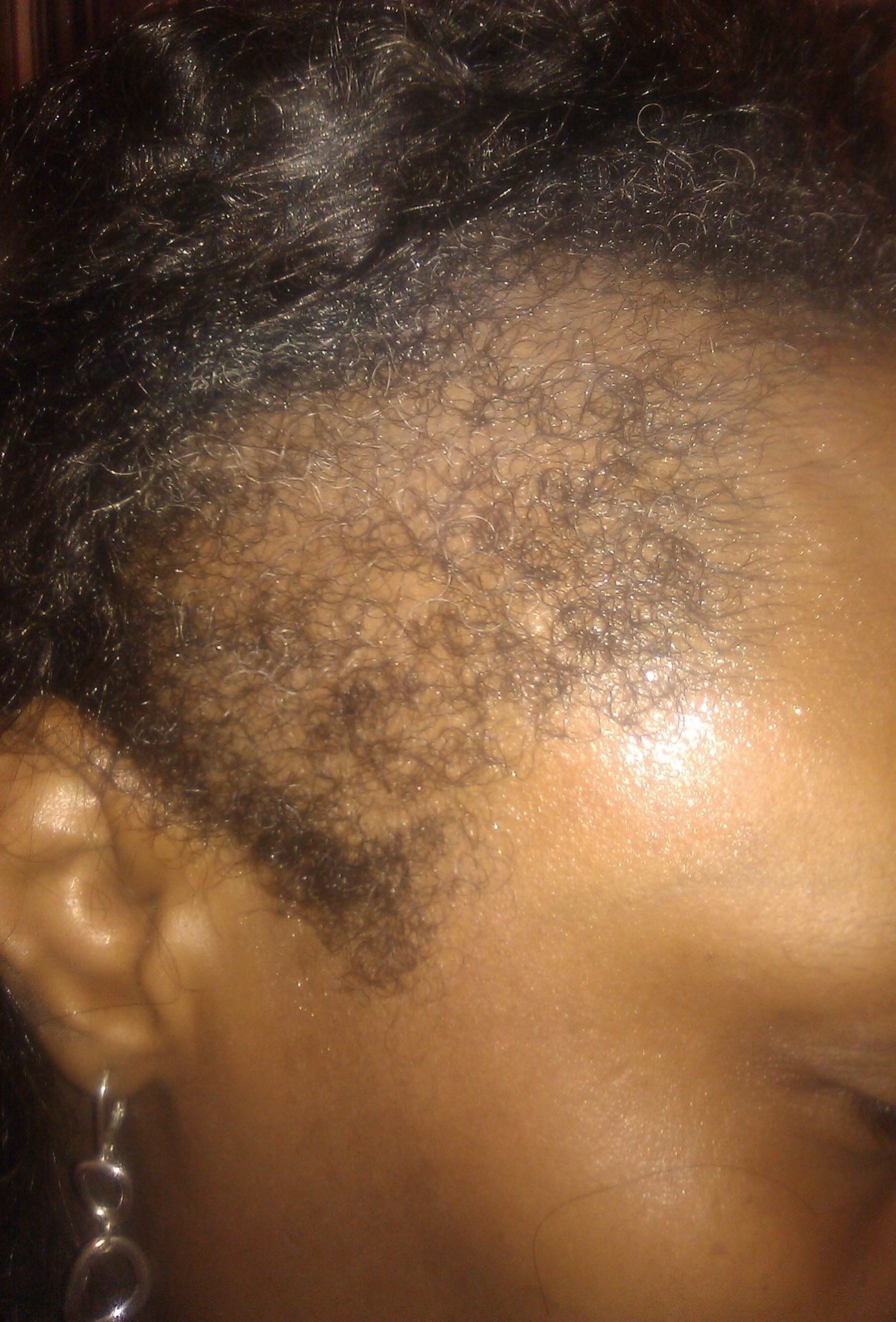 Repair and regrow damaged hair with Hair2Toe