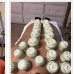 Masage Para Toda Clases De Dolores Con Ventosas